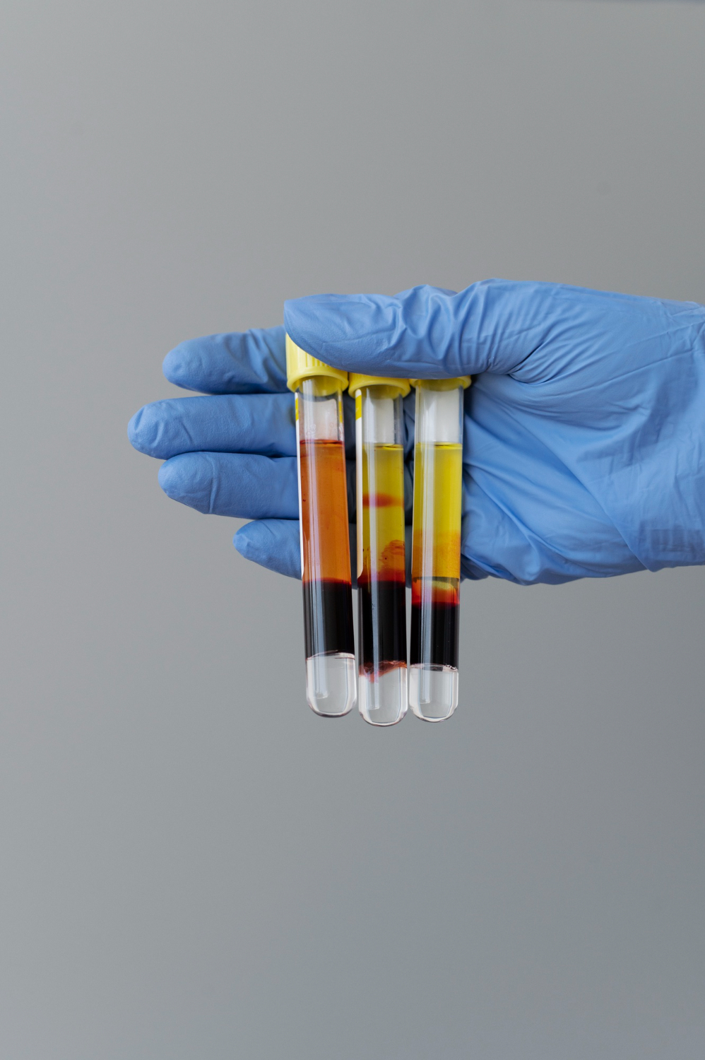 کیت‌ استخراج DNA